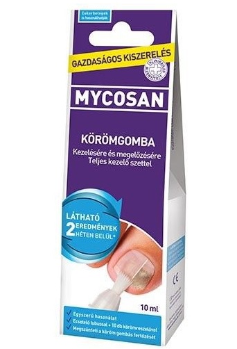 ízületi fájdalom a körömgomba miatt osteoarthritis 1 3 fok